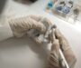 Why Some Dental Implants Fail and How to Prevent Them?